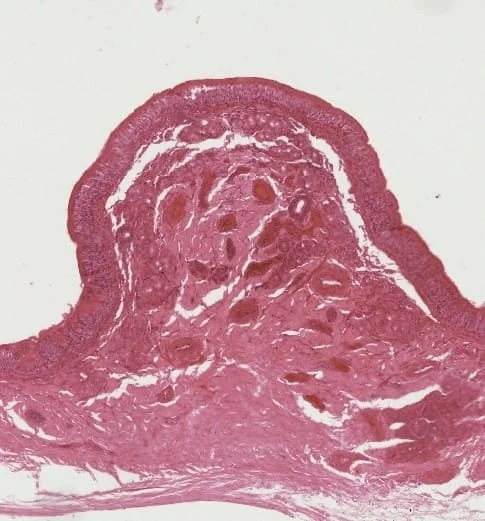 醫二 蒯彥如〈人類 你偷看我！〉 第三名